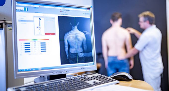3D Wirbelsäulenmessung Arzt vermisst die Wirbelsäule eines Patienten mit 3D-Scan